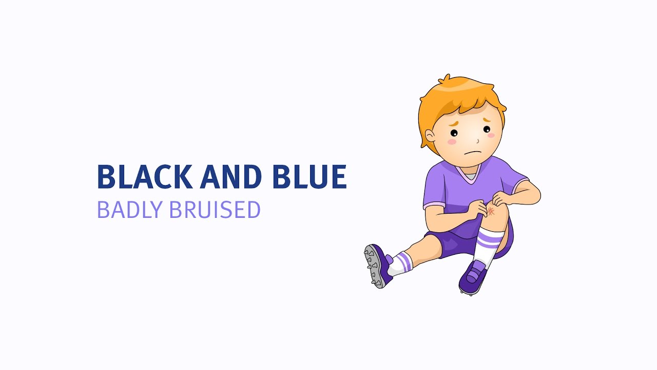 What Does Black And Blue Mean