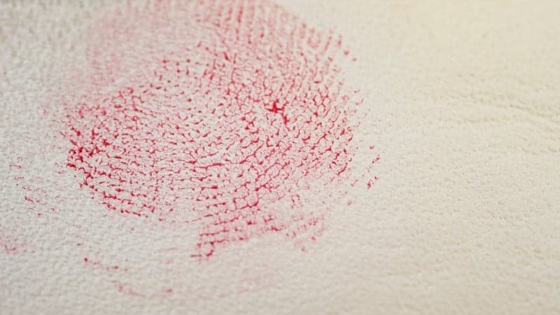 How To Get Blood Stains Out Of A Car Seat