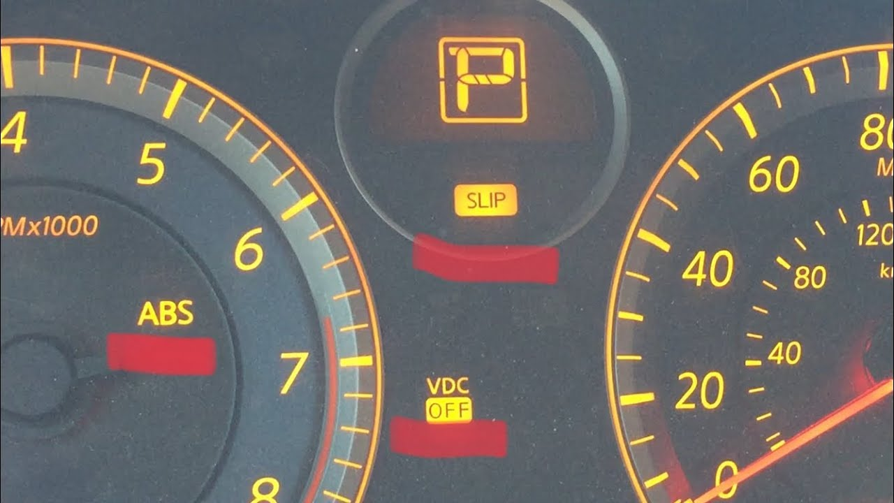 Que Significa Vdc Off Y Slip En Un Carro